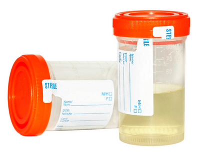Drugs of Abuse urine sample